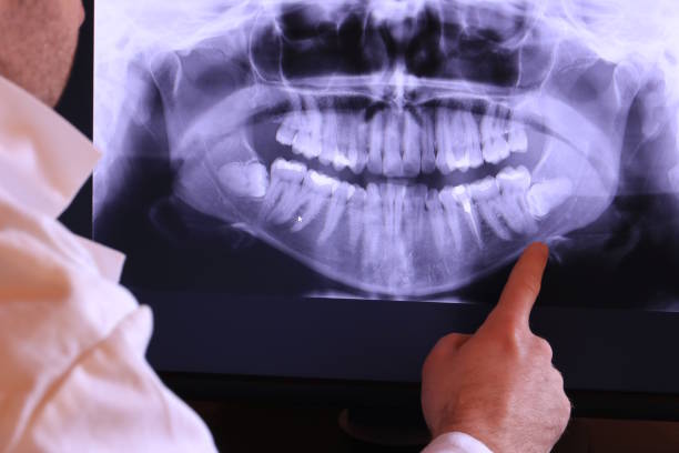 Best Pediatric Emergency Dentist in Larchmont, NY